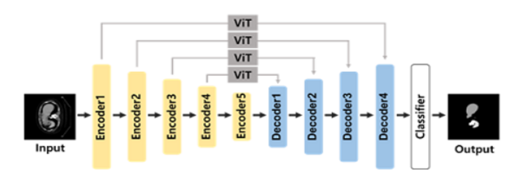 Main figure for U-Net의 skip architecture에 ViT를 적용한 segmentation 성능 개선에 관한 연구